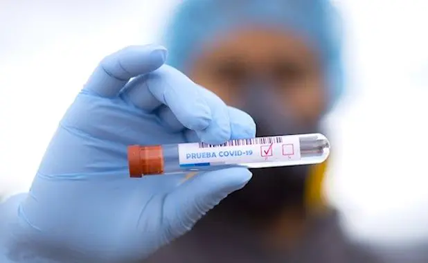 Des tests sérologiques, enfin disponibles en France, vont permettre de mieux suivre l'évolution de l'épidémie.