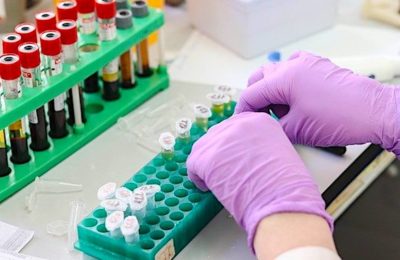 Des tests gratuits sont proposés près de Rouen, suite à la découverte de nouveaux clusters.