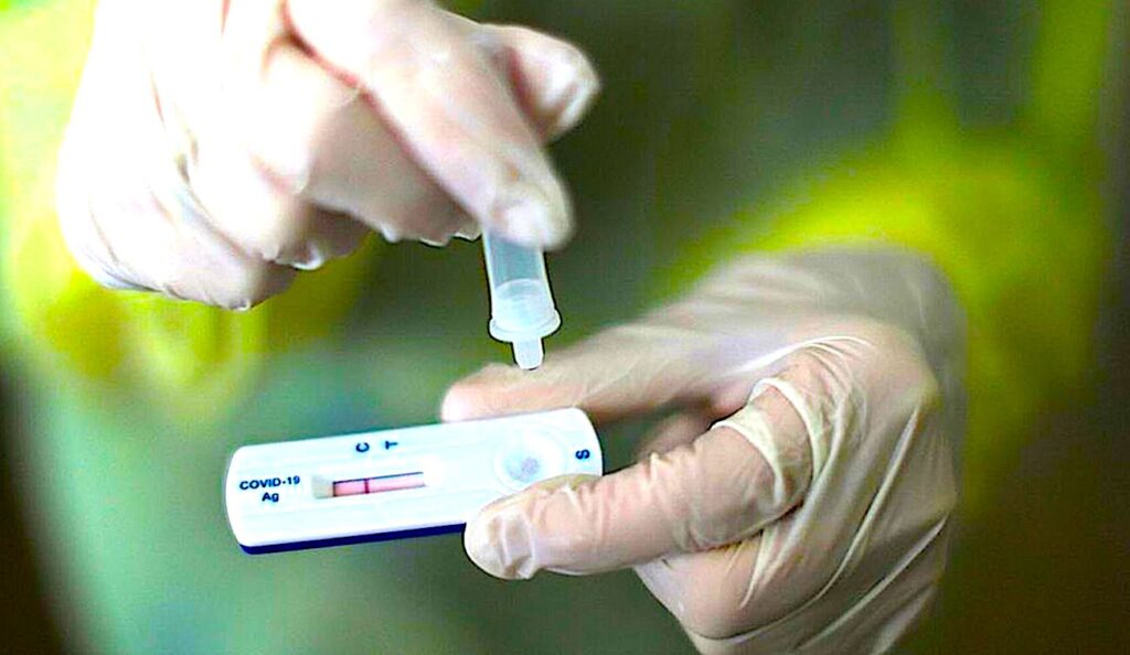 Des tests antigéniques, très rapides, seront bientôt accessibles