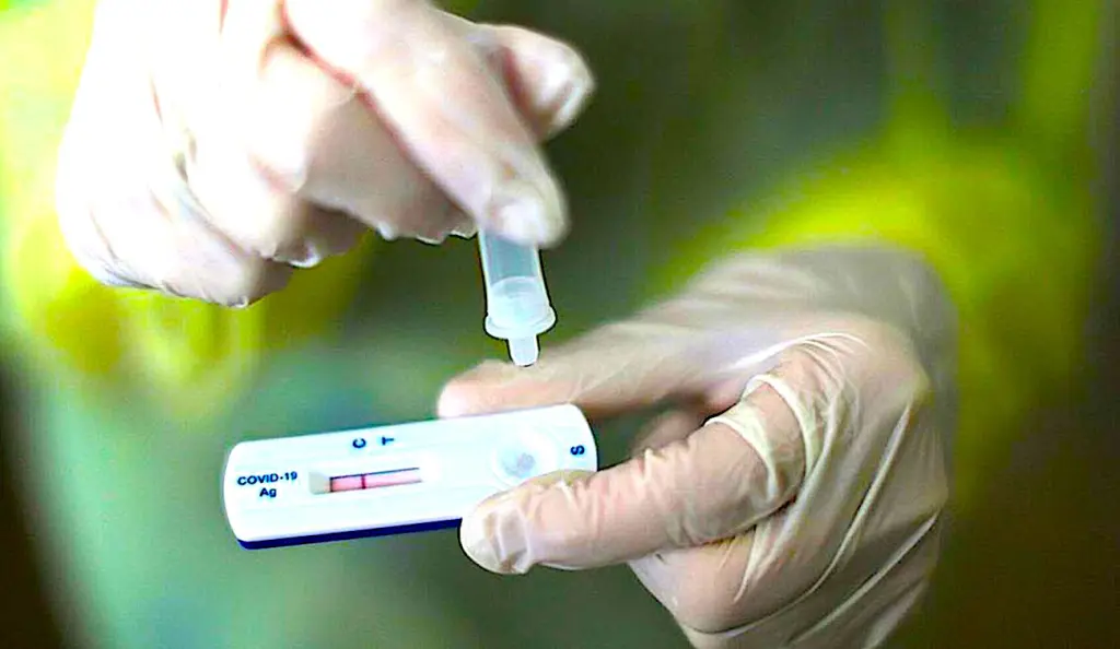 Des tests antigéniques, très rapides, seront bientôt accessibles
