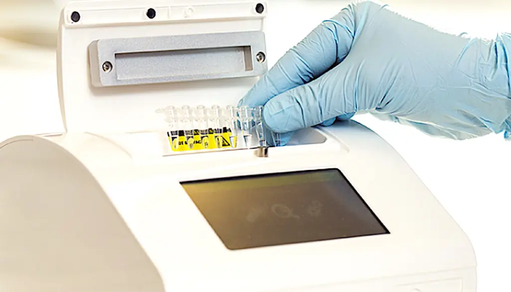 Un diagnostic Covid ultra rapide est désormais possible, grâce à un nouveau test