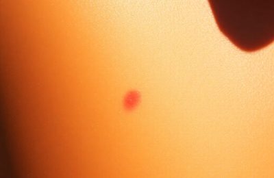 Soleil sur la peau bronzée, attention aux coups de soleil.